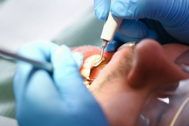 Emergency Gum Pain Relief in IL
