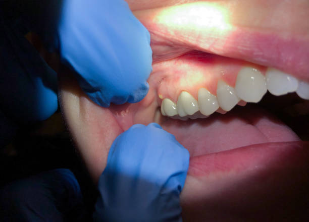 Best Teeth Whitening  in Stockton, IL